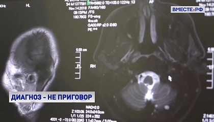 Пациенты с рассеянным склерозом должны оперативно получать необходимую медицинскую помощь, считают эксперты