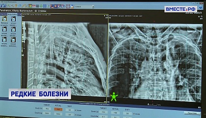 В России есть все для быстрого внедрения инновационных методов лечения орфанных заболеваний