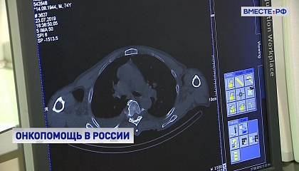 Сенатор Карелова считает, что нацпроект «Здоровье» уже показал хорошие результаты в борьбе с онкологией